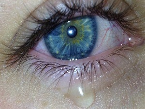 Göz sulanmasını ciddiye alın!