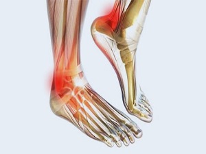 Diyabet hastalarının korkulu rüyası 'diyabetik nöropati'