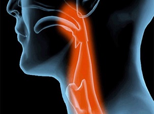 Yutma güçlüğü, tümör habercisi olabilir