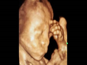 Anne karnında düşünen çocuk