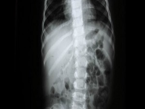 Omurga eğriliğine dikkat