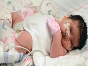 Kilosu ile dünyaya haber olan bebek