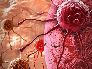 Kanser tedavisinde büyük gelişme