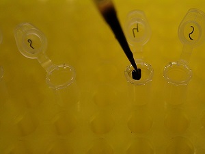 Alzheimer'da erken tanı umudu