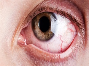 Bu ameliyat artık Türkiye'de yapılacak