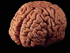 Beyin hasarı kök hücre ile tedavi edildi