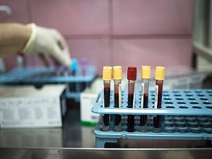 Türkiye'nin en hasta ilçesi!