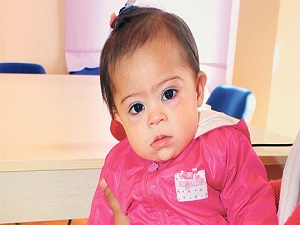 Bebeklerde boyun eğriliğine dikkat!