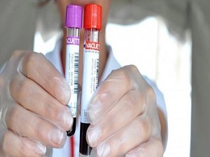 Kan testi sigarayı bırakmak için yol gösterecek