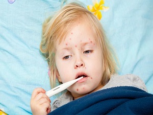 Çocuklarda 'altıncı hastalık' riskine dikkat!