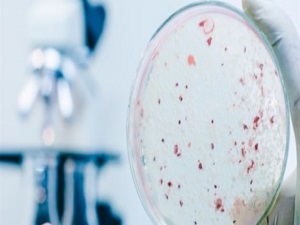 Türk mucitten cilt kanserini 10 saniyede teşhis eden cihaz