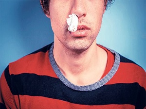 Burun kanamaları dikkate alınmalı