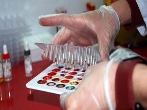 TÜRKÖK dünyaya da umut olacak