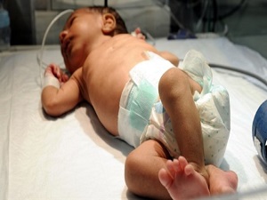 Kalça çıkığına karşı muayene şart