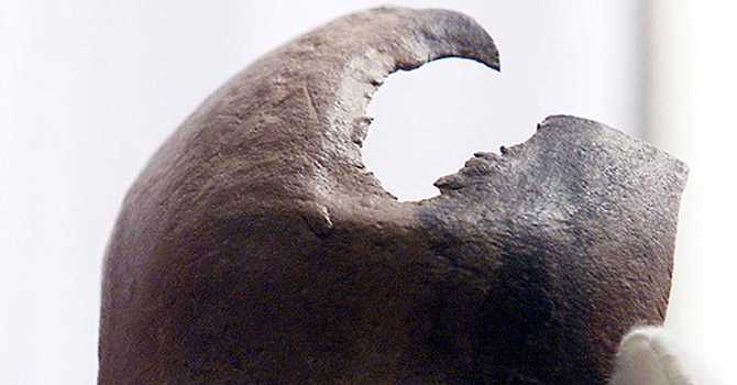 2500 yıl önce yapılan beyin ameliyatı