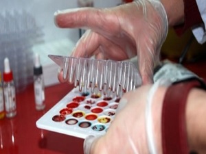 Kanserle mücadelede antioksidanlar başrolde