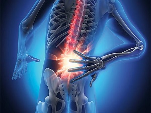 Sigara, bel ağrısını kronikleştiriyor