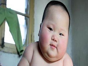 Türkiye obezitede OECD ülkeleri arasında 3. sırada