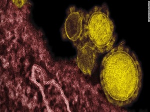 Dünyada MERS nedeniyle 358 kişi öldü