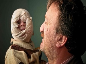 Suriye’de şark çıbanı tehdidi