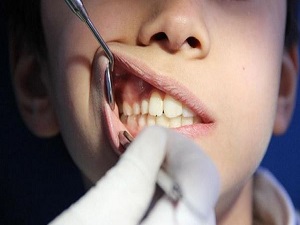 Çocuklarda diş muayenesi korkusunu önleyin