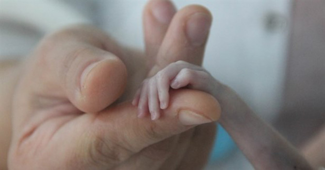 500 gramlık doğdu, dua bekliyor!