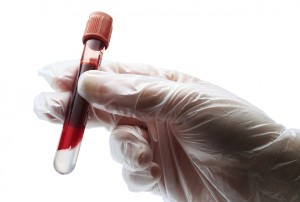 Hastayı kendi kanıyla iyileştiriyorlar