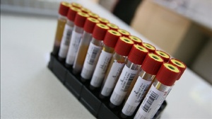 800 hastaya umut olacak