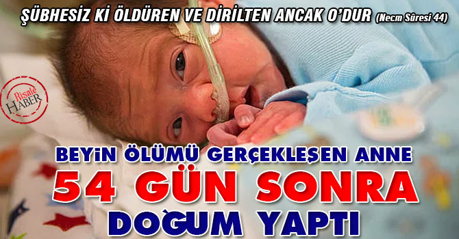 Beyin ölümü gerçekleşen anne 54 gün sonra doğum yaptı