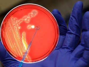 ABD'deki şarbon krizi büyüyor