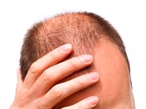 Saç dökülmesini önlemek istiyorsanız...