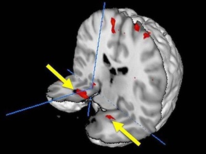 Ölüm korkusunun fotoğrafı çekildi
