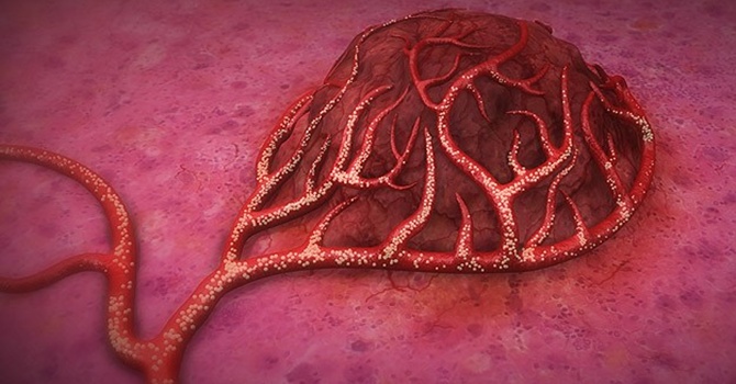 Kolon kanserinde yeni bir umut