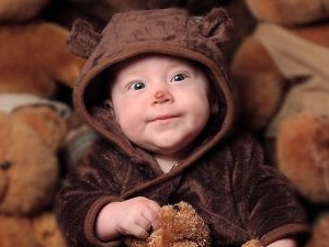 Sivilce özgüveni azaltıyor