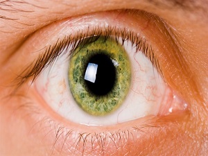 Göz tansiyonu tehlike saçıyor