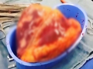 İnsan Kalbi dışarıda tam 25 dakika daha attı!