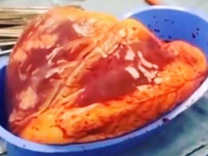 İnsan vücudundan çıkarılan kalp 25 dakika attı