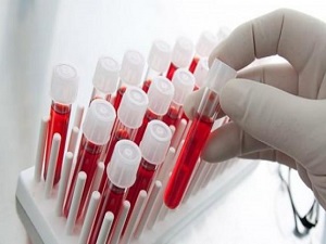 Türk doktor buldu! 100 hastalığa...