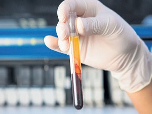 Tahlil sonucunuz yanlış olabilir