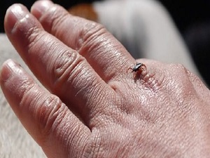 Böcek tarafından ısırılırsanız hemen bunları yapın!