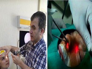 Yarasız ve iz bırakmayan operasyon