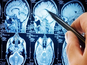 En sık çocuk ve yaşlılarda görülüyor