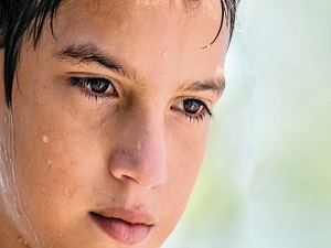 Aşırı terleme engellenebilir