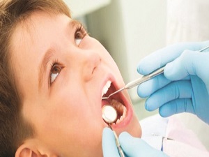 Süt dişlerdeki çürükler kalıcı dişlerde çapraşıklığa yol açabilir