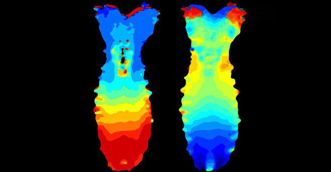 Sinir sistemi ilk defa görüntülendi