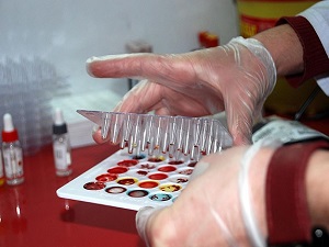 Kök hücre bağışçısı 60 bini geçti