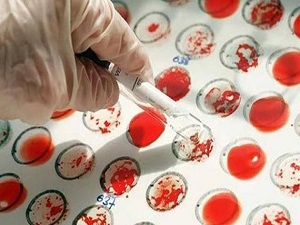 Bu kan gruplarına aman dikkat! Çünkü...