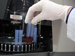 Sinir hasarının tedavisi bulundu