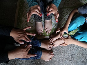 Suriyeli engelli kardeşler yardım bekliyor