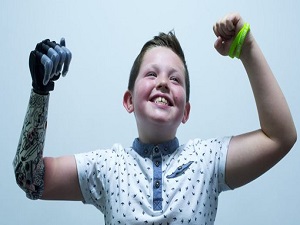 İngiltere'de ilk biyonik elli çocuk